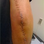 dog bite attorney los angeles
