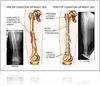 goldberg2455-1000-ffccccccWhite-3333-0.20.3-1 Los Angeles Auto Accident Attorney