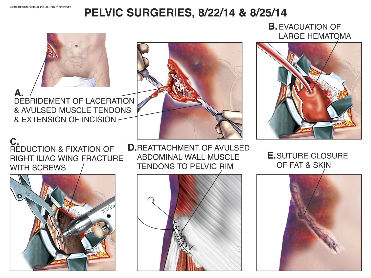 surgery exhibit
