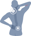 1471420113_Cervical